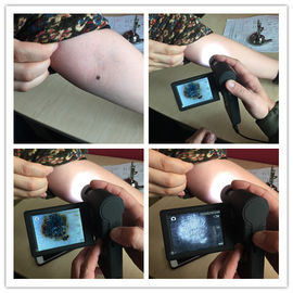 Profesional Elektronik Video Dermatoscope Inspeksi Kulit Dengan Kartu Micro SD