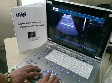 PC berbasis B / W Portable Ultrasound Scanner 15 inch Laptop layar hanya 5kgs berat strategis untuk menjalankan