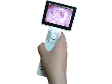 Kamera Digital Skin Hair Magnifier Machine Dengan Mini USB Port Mengirimkan Gambar ke PC Menampilkan Gambar pada Saat yang Sama