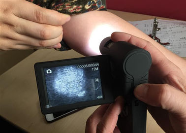 Video Kulit Mikroskop Dermatoskop Portabel Dengan Layar Rotatable 3 Inch TFT Color