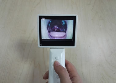 Penyimpanan Kartu SD Peralatan Diagnostik THT Otoscope Ophthalmoscope Secara Otomatis Dengan Kabel USB