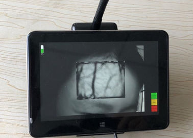 Warning: preg_replace_callback(): Requires argument 2, 'cleanGoogleLink', to be a valid callback in /data/www/libs/myt/tran/google4vps.php on line 263
Resolusi 800 * 1280 Near Infrared Projectiion Vein Finder Portable Medical Vein Viewer