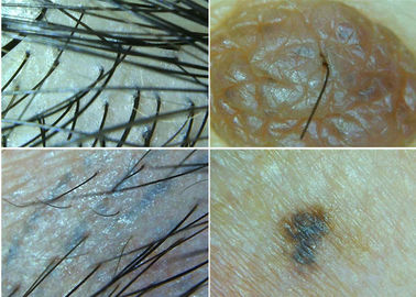 Mikroskop Nirkabel Digital Dermatoscope Terhubung Ke Komputer Untuk Pemeriksaan Kulit Dan Rambut