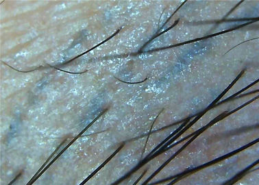 1000x Magnifier Skin Microscope Digital Video Dermatoscope Untuk Pemeriksaan Medis Mikroskop Penuh