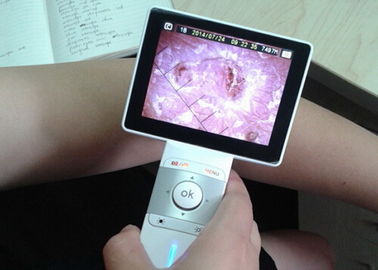 Genggam Kulit Dan Analisis rambut Video dermatoscope Dengan 3,5 Inch LCD Colorful