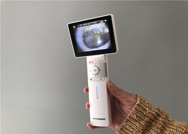 Digital Video Otoscope Dermatoscope Dan Lingkup Inspeksi Pencitraan Umum Dengan 3,5 &quot;Full Color TFT-LCD