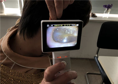 Lcd monitor Digital Video Otoscope Optalmoskop Untuk Pemeriksaan Klinis Tubuh Manusia
