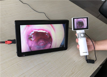 Otoscope Portabel Ophthalmoscope Video Throat Camera Dermatoscope Dengan Output Kartu SD Untuk Klinik