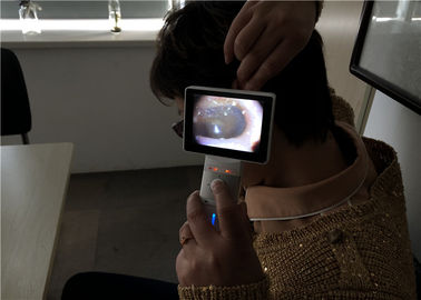 Cahaya Putih Netral Digital Video Otoscope Dermatoscope Dan Otoscope Camera Dengan Resolusi Tinggi