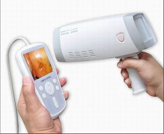 Digital Handheld serviks Kamera colposcope untuk Ginekologi untuk Periksa Cervix dengan 80,0000 Pixel Resolusi 1 ~ 128 Zoom