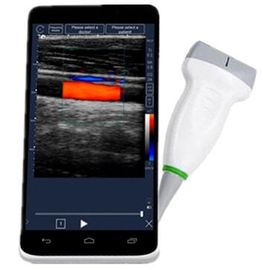 Mobile Full Digital Portable Mesin Ultrasound Nirkabel Dengan Layar Sentuh LCD 6 Inch