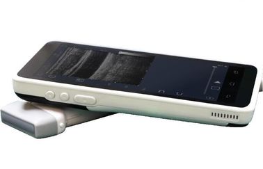 Perangkat Sonogram Genggam Mini Color Doppler Dengan Resolusi 128 Elemen 1280 * 720
