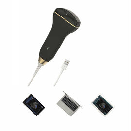 Digital Smart Handheld Ultrasound Scanner Probe Ultrasound Nirkabel Untuk Panduan Tusukan