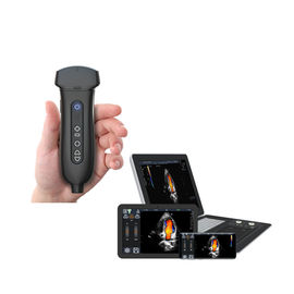 Mobile Hand Ultrasound Machine Probe Ultrasonication Didukung Windows / Android / IOS