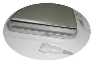 3d Color Doppler Ultrasound Scanner / Hand Held Doppler Dengan Baterai Bawaan