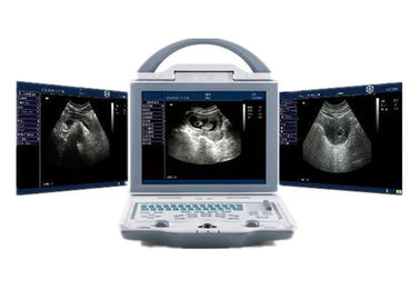 Mesin Ultrasound Rumah Sakit Scanner Ultrasound Portabel dengan Konektor Probe Ganda