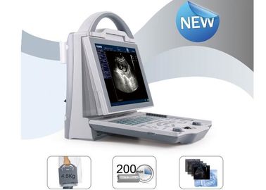 Mobile Ultrasound Scanner Portable Ultrasound Scanner dengan Transvaginal Linear Convex Probe