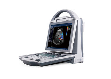 Perangkat Genggam Ultrasound Scanner Ultrasound Portabel Doppler Warna Dengan Kapasitas 16G
