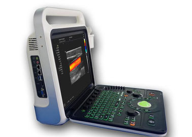 Mesin Pencitraan Ultrasound Scanner Ultrasound Portabel dengan Kapasitas 160G