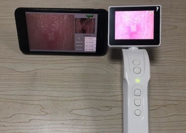Handheld Digital Dermatoscope Video Dermatoscope Koneksi Wifi ke Mobilephone Layar 3,5 Inch
