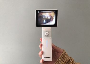 Kartu Micro SD USB Telinga Kamera Digital Video Otoscope Pencitraan Umum Dan Dermatoskop