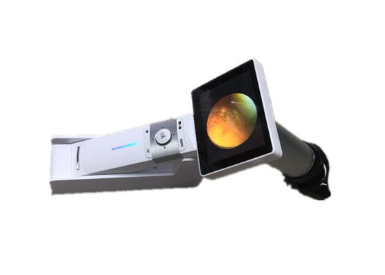 Perangkat Ophthalmoscope Video 1920 X 1080 Piksel 3,5 &quot;