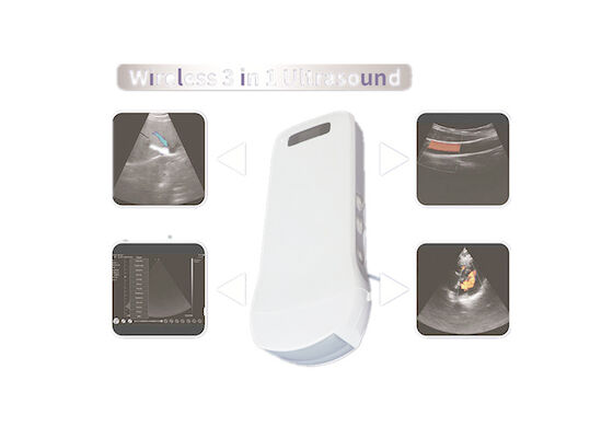 Digital Wireless Handheld Ultrasound Scanner Koneksi Wifi Cardiac Linear Convex 3 IN 1 Wireless Charging 6 Bahasa