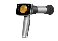 160 Juta Resolusi Pixel Fokus Otomatis Ophthalmic Handheld Fundus Camera Untuk Diagnosis Jarak Jauh