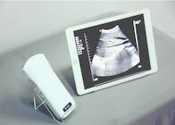 Perangkat Ultrasound Portabel Genggam Seluler Digital Cembung + Linear + Transduser Ultrasound Nirkabel Cardiac 3IN1