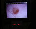 Lcd monitor Digital Video Otoscope Optalmoskop Untuk Pemeriksaan Klinis Tubuh Manusia