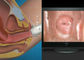 Digital Endoskopi Inspeksi-Sendiri Kolposkopi Mini Kolposkopi dengan Rentang Pengamatan 70 ~ 100mm