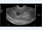 Transvaginal Endocavity Ultrasound Scanner Probe Nirkabel Untuk Perangkat Seluler OB / GYN