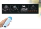 Genggam Kandung Kemih Portabel Pemindai Micro Convex Probe Ultrasound Kehamilan Hewan