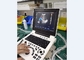 Mesin Diagnostik Ultrasound Portable Laptop Probe Color Doppler Equipment