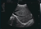 Ultrasound Doppler Pada Kehamilan Home Doppler Ultrasound Probe Frekuensi 12MHz