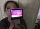 THT Endoskopi Rhinoskopi Kamera Video Medis Otoscope Digital Untuk Pemeriksaan Hidung Dengan LCD
