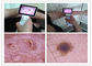 Inspeksi Klinis THT Tubuh Manusia Digital Video Otoscope Dengan Warna TFT LCD USB Otoscope