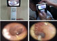 1920 x 1080 piksel CMOS Smart Medical USB Video Otoscope Untuk Kulit Telinga Dan Pencitraan Umum