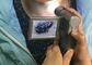Perangkat Inspeksi Kulit Dan Rambut Elektronik Kamera Video Dermatoscope Dengan Layar Warna TFT 3 Inch