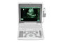 Digital Portable Mobile Laptop Ultrasound Scanner Peralatan Medis BIO 3000J Dengan Layar LED 1,12 Inch