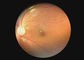 Peralatan Optik Kedokteran Kamera Tenggorokan Video Otoscope Dermatoscope Endoskopi Digital Dengan 2 Juta Piksel