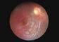 Peralatan Optik Kedokteran Kamera Tenggorokan Video Otoscope Dermatoscope Endoskopi Digital Dengan 2 Juta Piksel