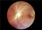 Fokus Otomatis Video Medis Ophthalmoscope Dengan FOV 45 °