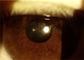 Lampu Celah Genggam Kamera Ophthalmoscope Portabel