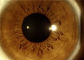Alat Ophthalmic Portabel Non Mydryatic Digital