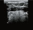 Peralatan Diagnostik Genggam Ultrasound Scanner Nirkabel Dengan 8 Penyesuaian TGC
