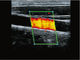 Peralatan Diagnostik Genggam Ultrasound Scanner Nirkabel Dengan 8 Penyesuaian TGC
