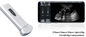 Mutil Language Fetal Color Doppler Ultrasound Scanner Dengan Micro - Convex Probe