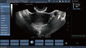 Transvaginal Probe Mobile Color Doppler Ultrasound Scanner Untuk Kehamilan
