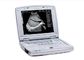 Mesin Ultrasound Scan Scanner Ultrasound Portabel dengan Monitor LED 10,4 Inch